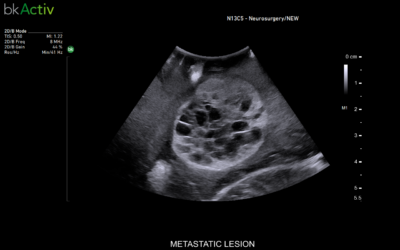 NÝTT ÓMTÆKI BKACTIV