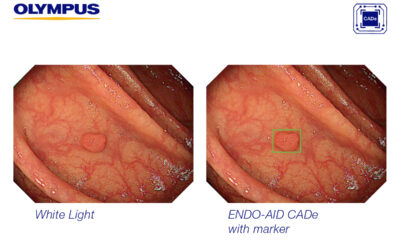 SKIMUN FYRIR KRABBAMEINI Í RISTLI OG ENDAÞARMI HEFST Á NÆSTA ÁRI